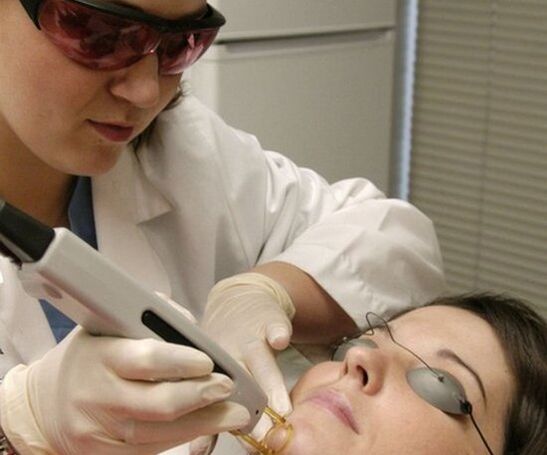 Laser facial rejuvenation procedure