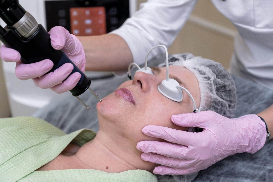 Objective laser skin rejuvenation procedure