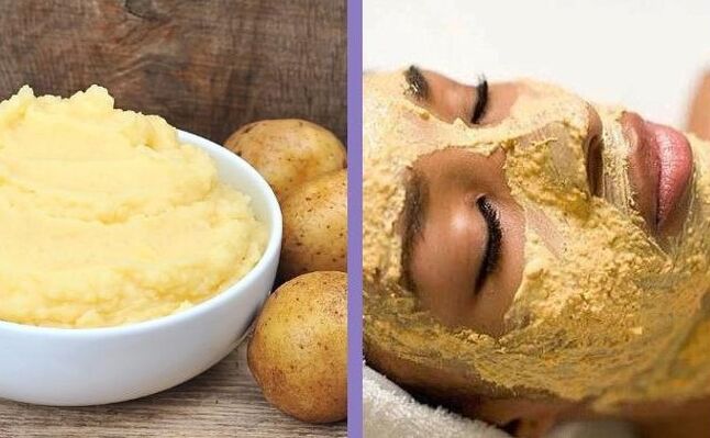 Potato mask