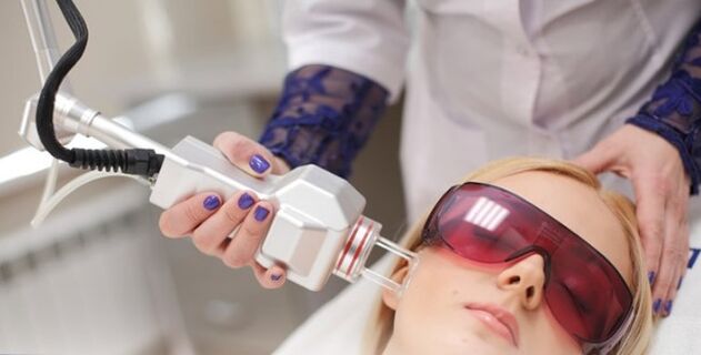 The principle of tension with Laser